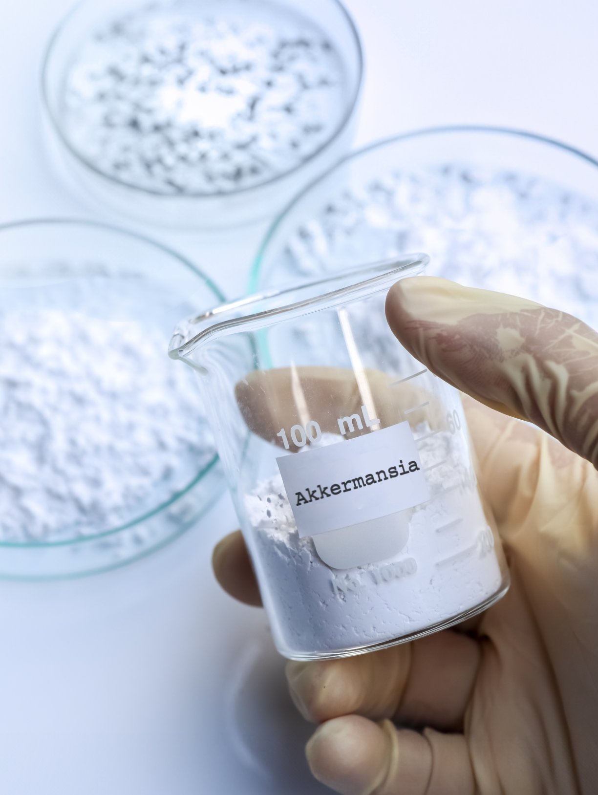 Akkermansia muciniphila strain in lab preparation