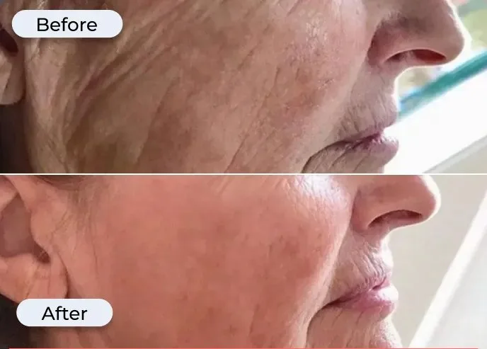 Before and after photo from Glamory's offer page showing under-eye fine lines