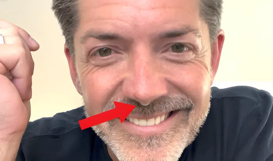 Hale vs. Nasal Strips, Sprays, And Surgery