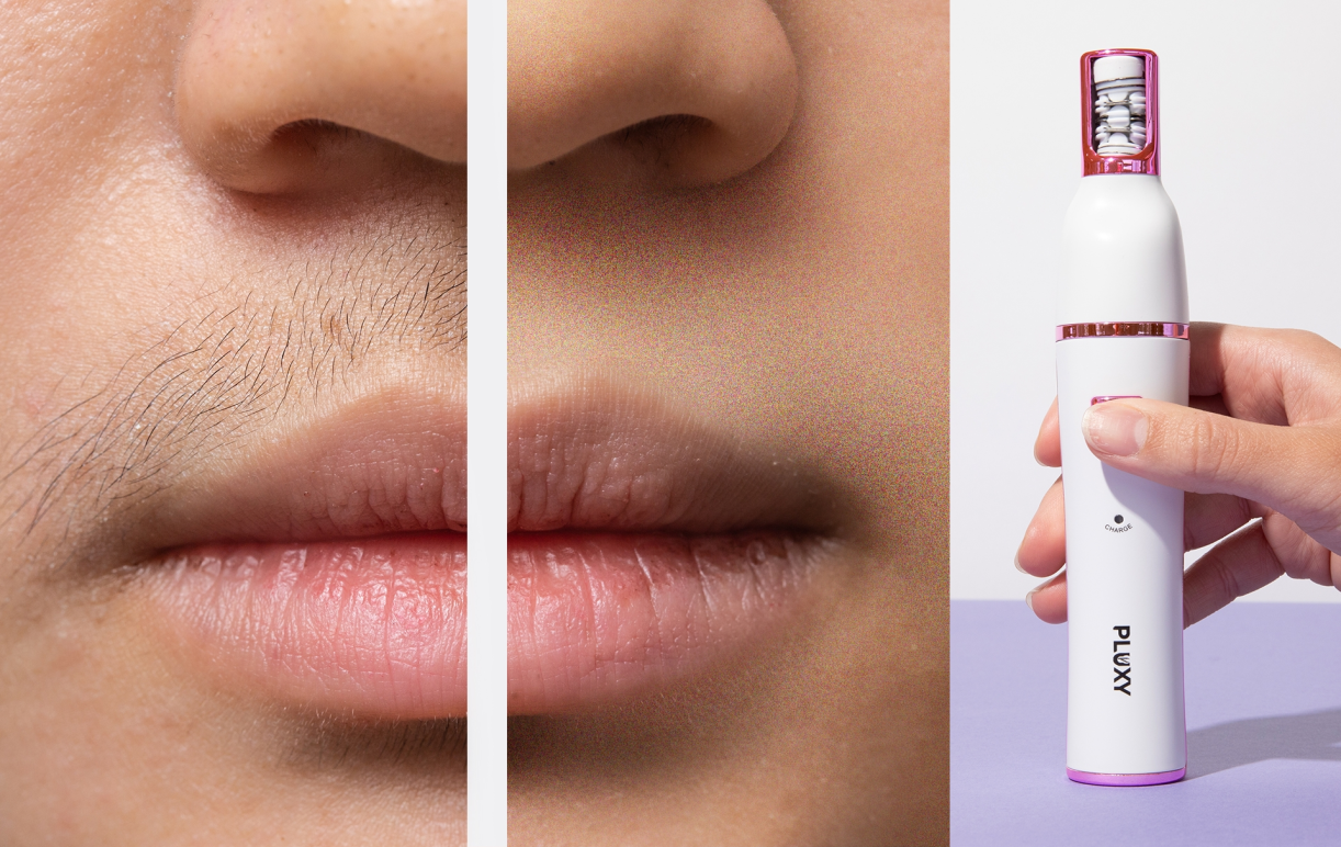 Close-up before and after of upper lip hair removal with Pluxy