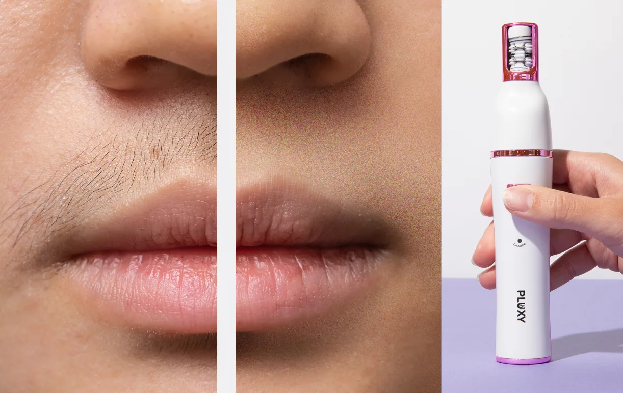 Close-up before and after of upper lip hair removal with Pluxy