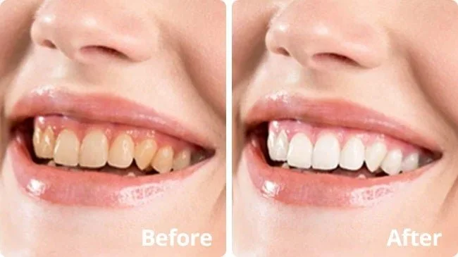 Our Real-World Experience With PurelyWHITE Deluxe