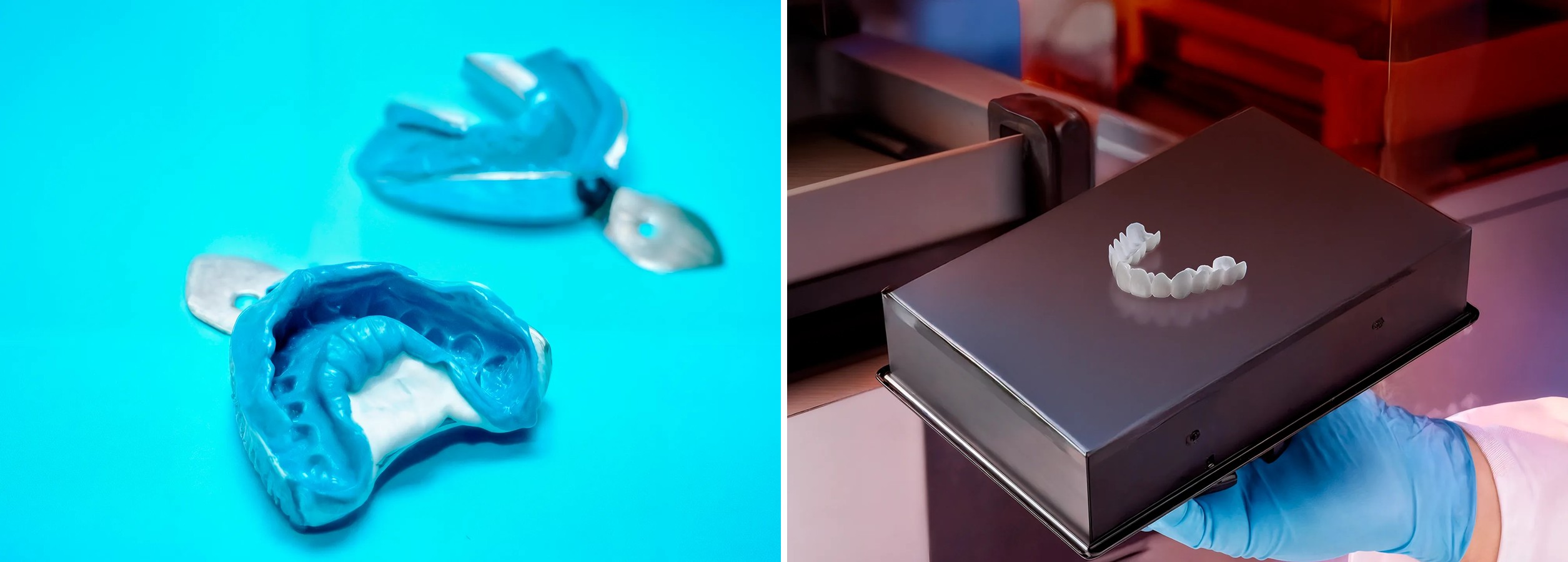 Dental impression trays and a gloved hand holding a veneer for Shiny Smile
