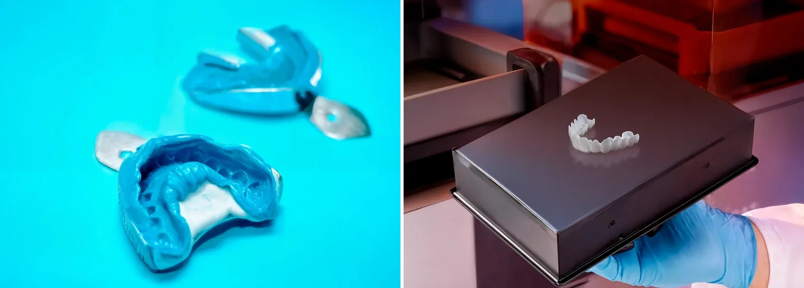 Dental impression trays and a gloved hand holding a veneer for Shiny Smile