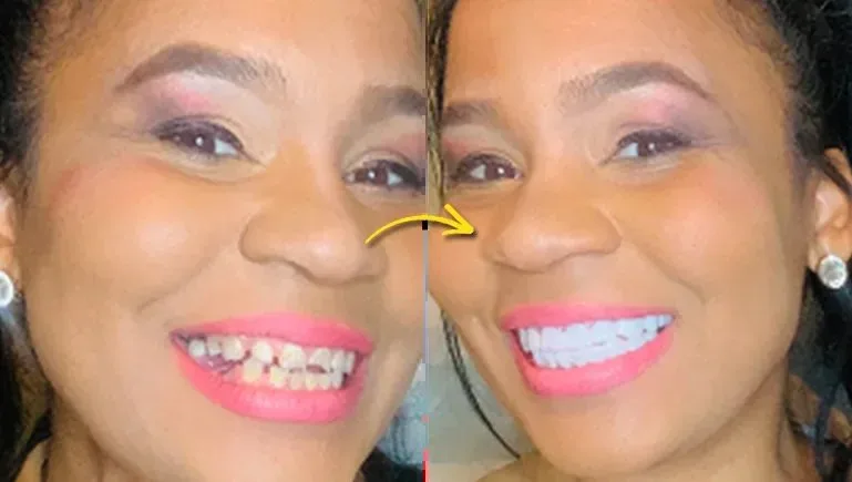 Our Real-World Experience With Shiny Smile