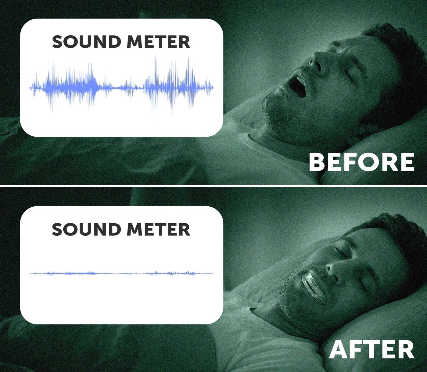 Before-and-after snoring comparison with SnoreRX