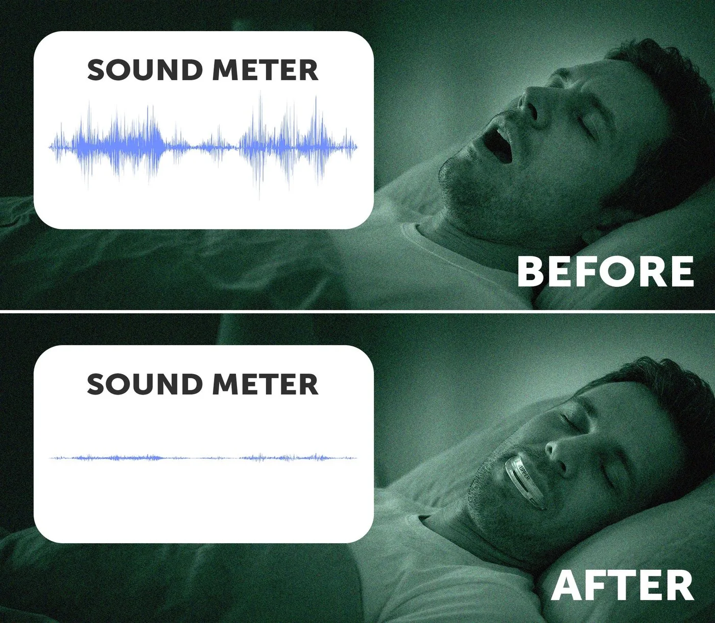 Before-and-after snoring comparison with SnoreRX